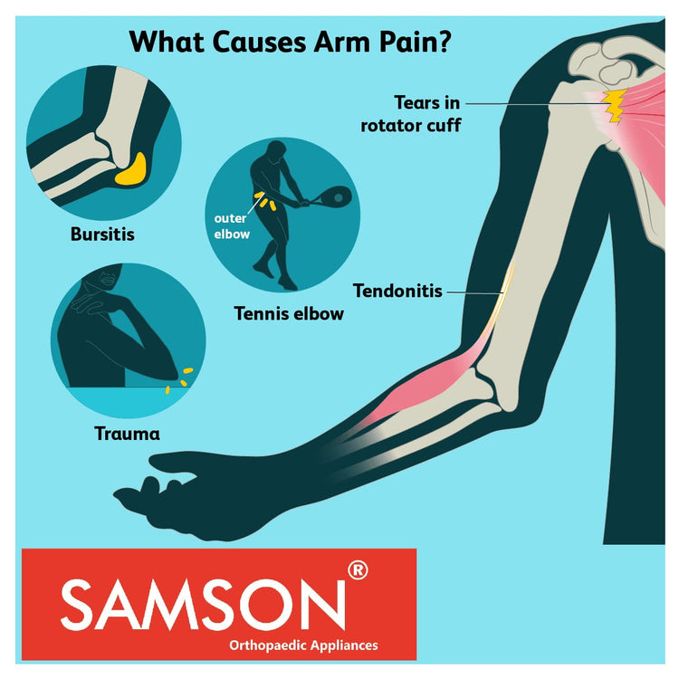 Samson Arm Immobilizer Brace (Elbow Splint Support) : Lightweight Breathable Anatomically Shaped Wrist Elbow Support for Dislocation, Fracture, Sprains & Broken Arm (Universal Size)