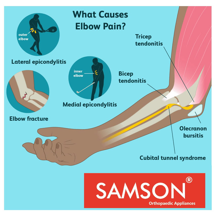 Samson Arm Immobilizer Brace (Elbow Splint Support) : Lightweight Breathable Anatomically Shaped Wrist Elbow Support for Dislocation, Fracture, Sprains & Broken Arm (Universal Size)