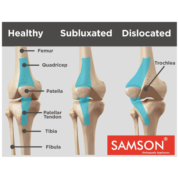 Samson Knee Cap Hinged with Patella Gel Pad - For Arthritis, Sports Injury, Joint Pain Relief, Knee Stabilizer & Support (For Women & Men)