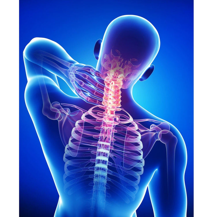 Uniherbs India Oil AVN Cervilon Oil : A Proprietary Formula for Cervical Spondylosis, For Cervical Spondylosis, Osteoarthritis of Facet Joints (120 ml) (30 ml X 4)